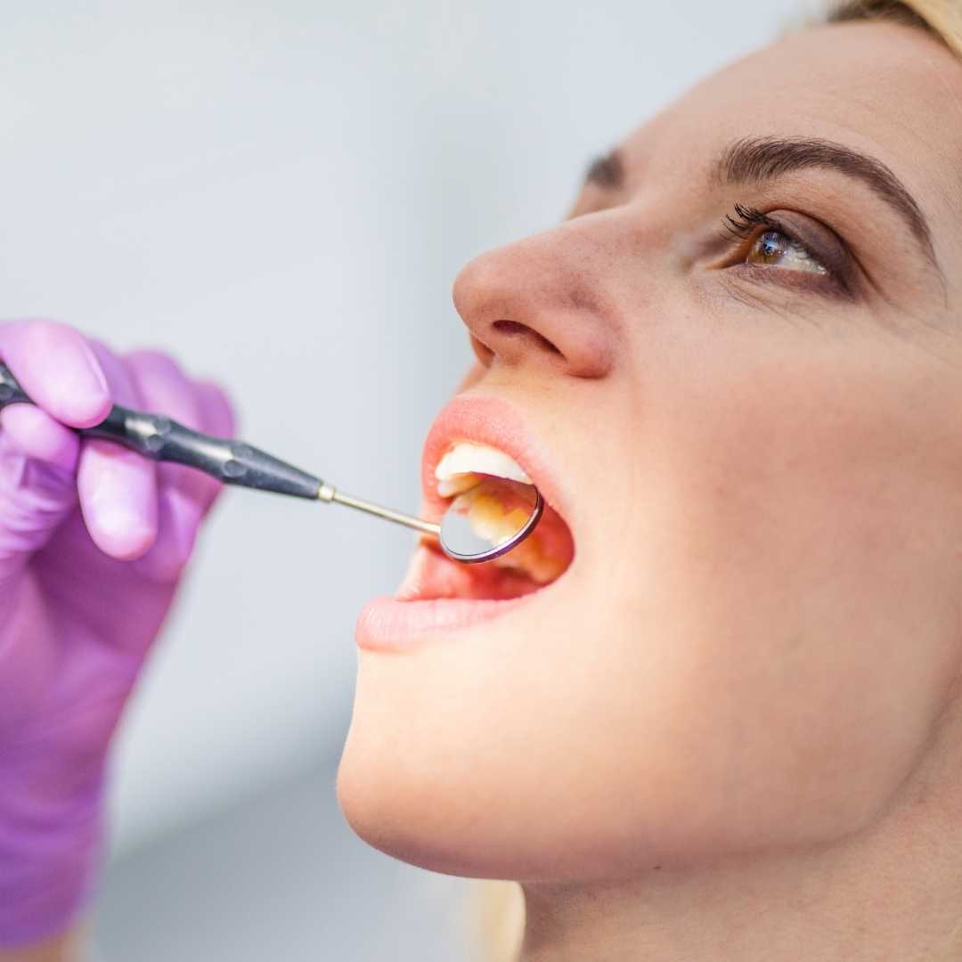 Dental Exams at Crafting Smiles Dentistry in Richmond Hill