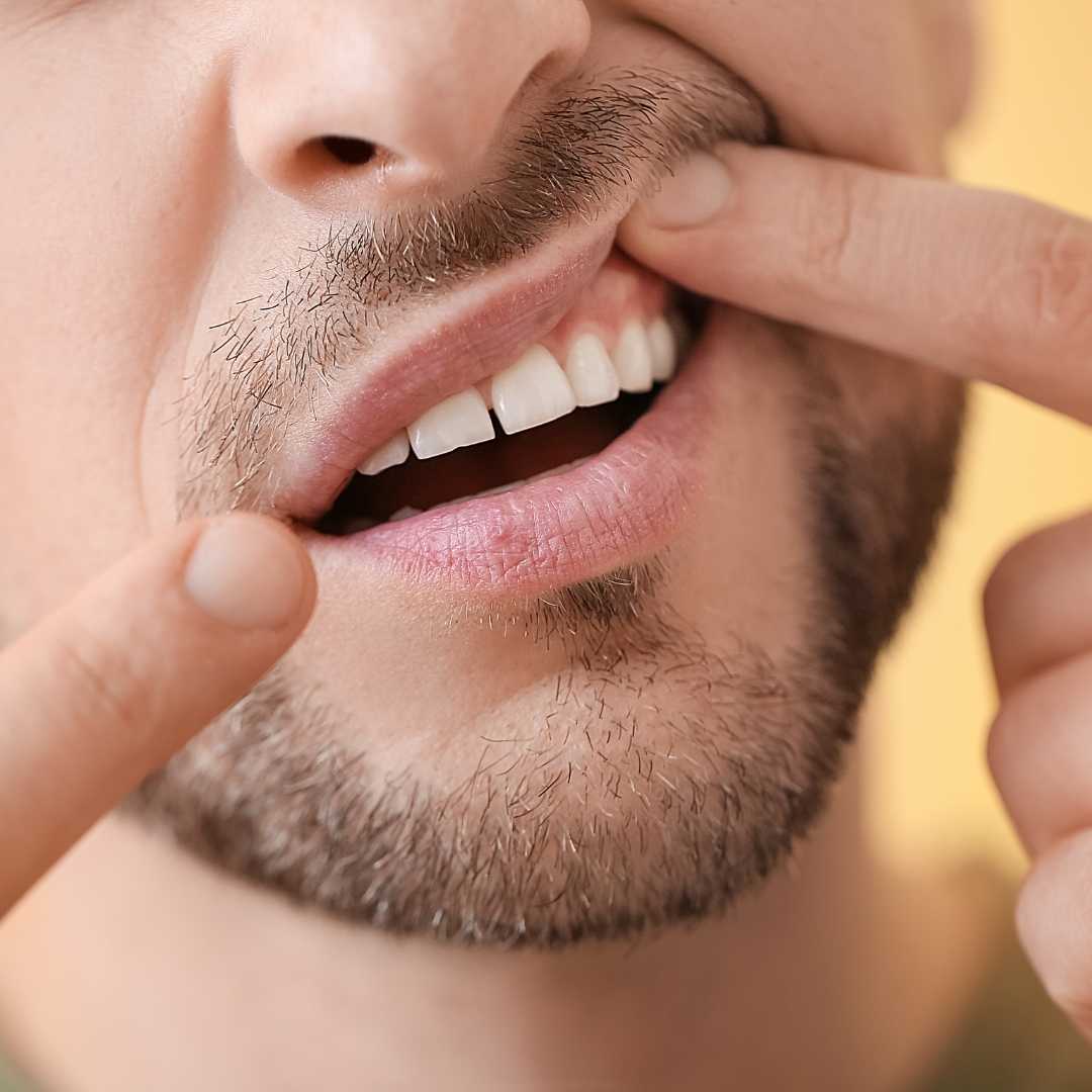 Gum Disease Treatment at Crafting Smiles Dentistry in Richmond Hill